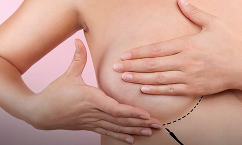 O câncer de mama se tornou a forma mais comum da doença